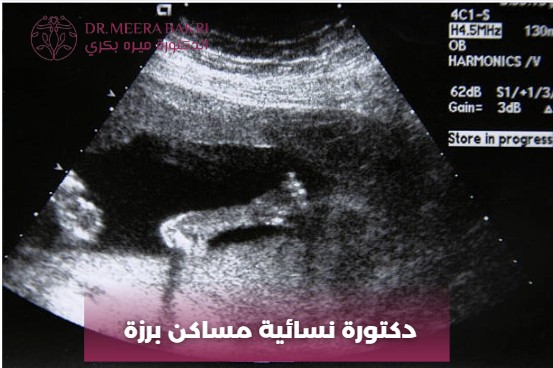 دكتورة نسائية المزة شيخ سعد