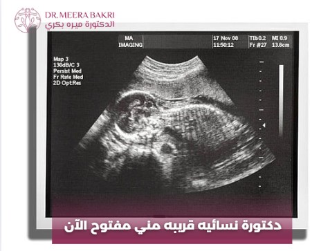  دكتوره نسائيه قريبه مني