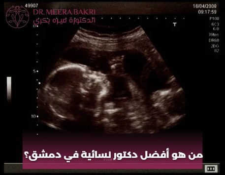 من هو أفضل دكتور نسائية في دمشق؟