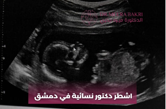 اشطر دكتور نسائية في دمشق