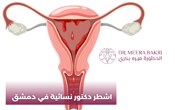 دكتورة نسائية دمشق