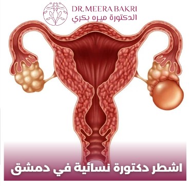 دكتورة نسائية في دمشق شارع بغداد