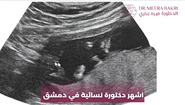 دكتورة نسائية في دمشق المزة