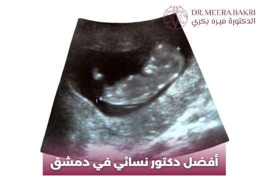 دكتورة نسائية في شارع بغداد