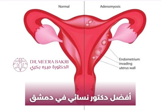 افضل دكتور نسائية في دمشق