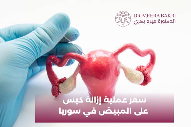 سعر عملية إزالة كيس على المبيض في سوريا