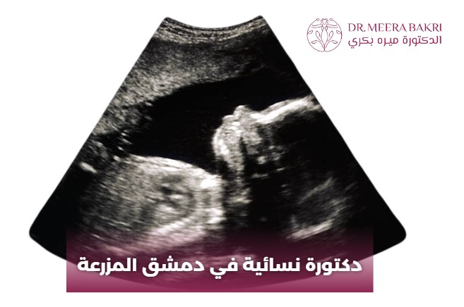 دكتورة نسائية في دمشق المزرعة