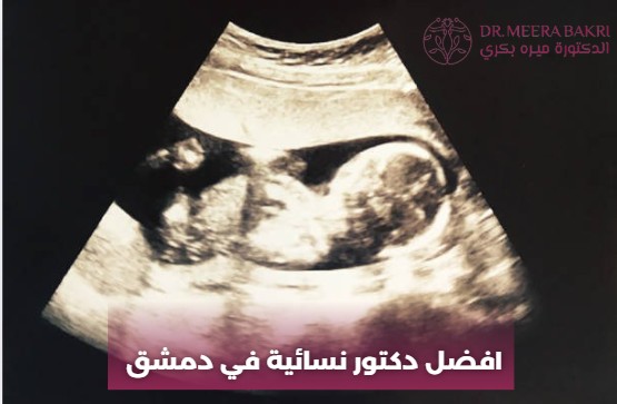 دكتورة نسائية في شارع بغداد