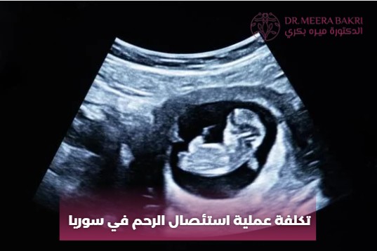 نسبة نجاح عملية استئصال الرحم