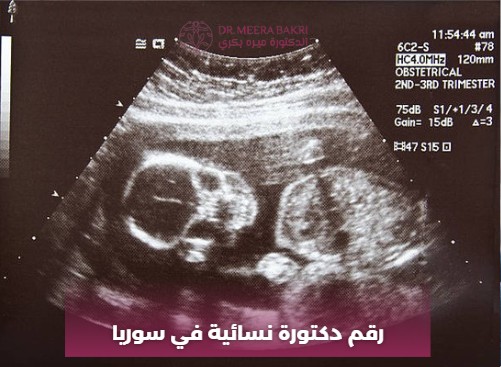 رقم دكتورة نسائية في سوريا