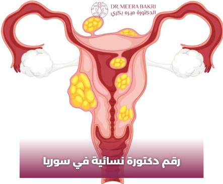 اشطر دكتورة نسائية في دمشق