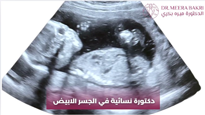 دكتورة نسائية في دمشق, شارع بغداد