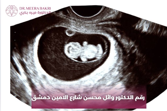 رقم الدكتور وائل محسن شارع الامين دمشق