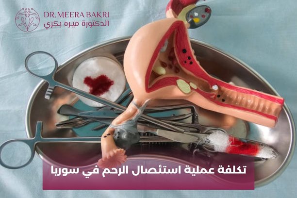 هل تختلف تكلفة عملية استئصال الرحم في سوريا بناءً على خبرة الطبيب؟