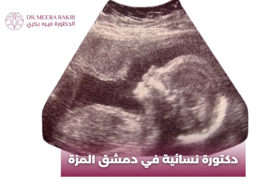 دكتورة نسائية في دمشق المزة