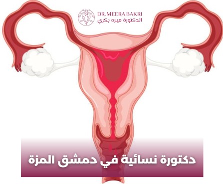 دكتورة نسائية في دمشق, شارع بغداد
