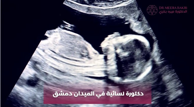 دكتورة نسائية في الميدان دمشق