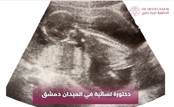 دكتورة نسائية في الميدان دمشق