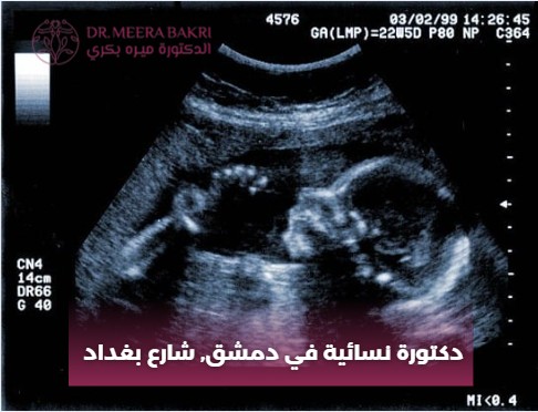 دكتورة نسائية في دمشق, شارع بغداد