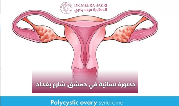 دكتورة نسائية دمشق - باب مصلى