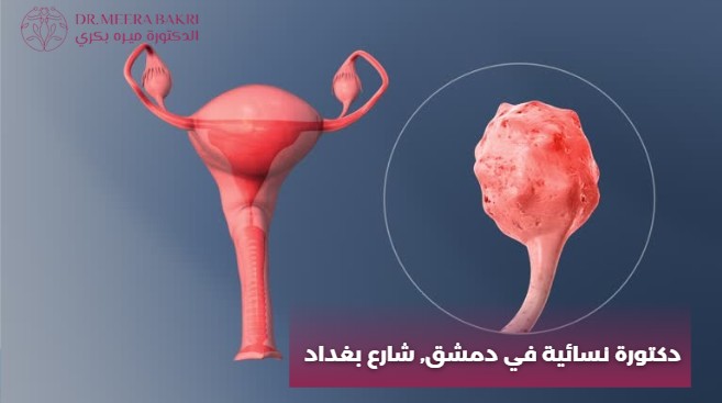 دكتورة نسائية في دمشق