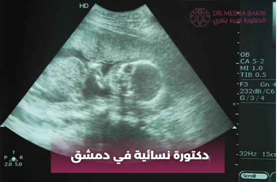 دكتورة نسائية في دمشق