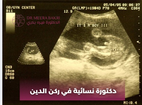 دكتورة نسائية في ركن الدين