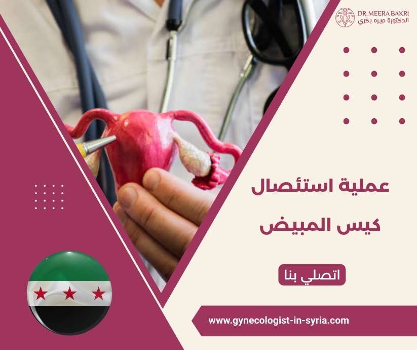 عملية استئصال كيس المبيض