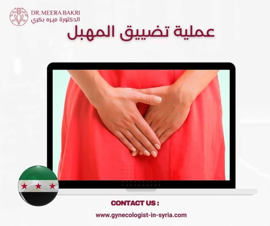 عملية تضييق المهبل