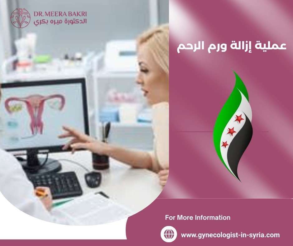 عملية إزالة ورم الرحم