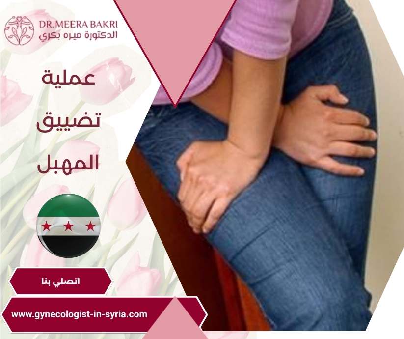 عملية تضييق المهبل