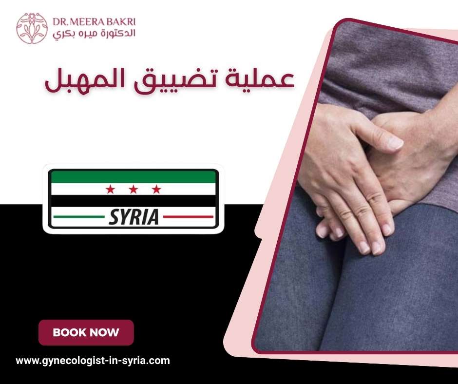 عملية تضييق المهبل