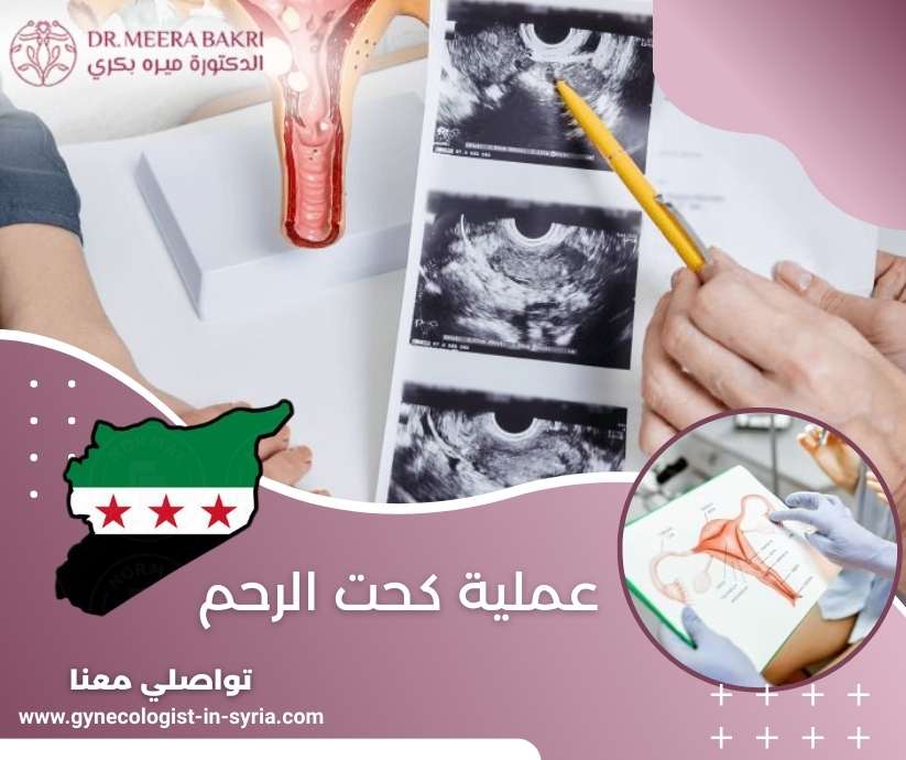 عملية كحت الرحم