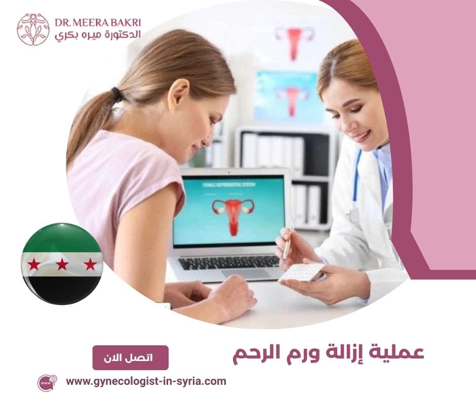 عملية إزالة ورم الرحم