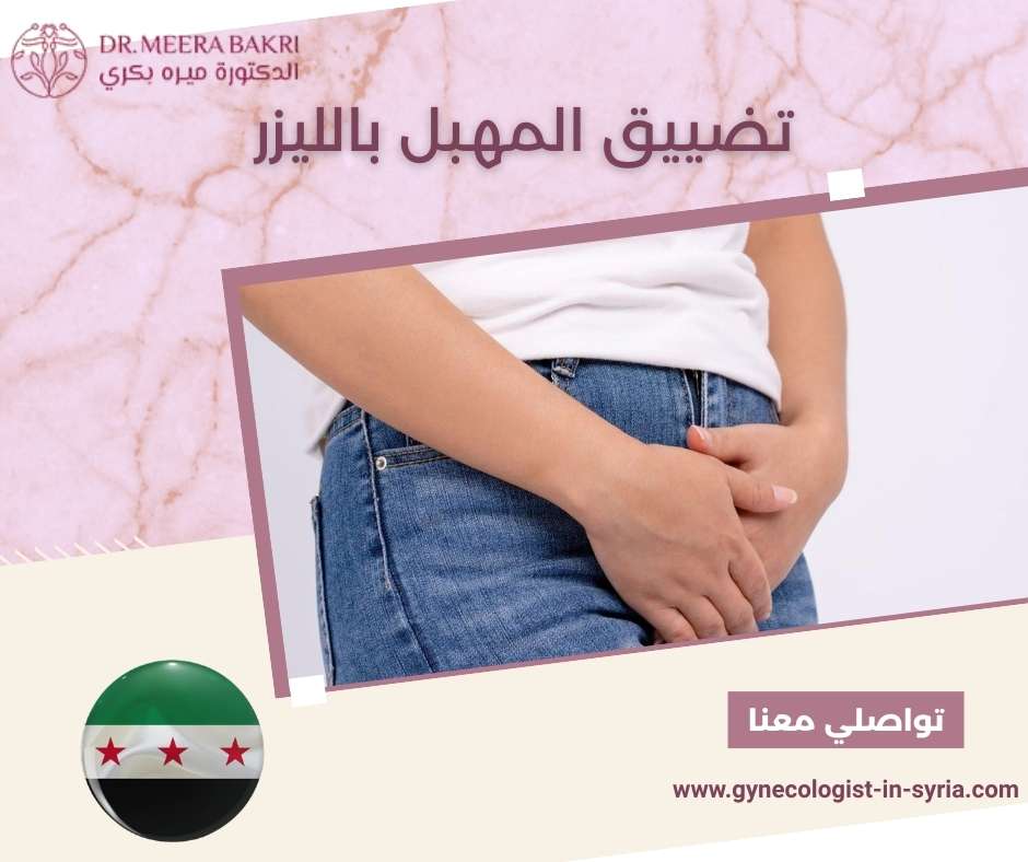 تضييق المهبل بالليزر