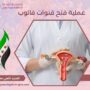 عملية فتح قنوات فالوب