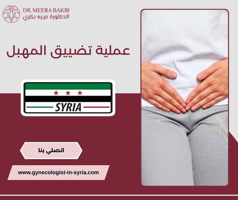 عملية تضييق المهبل