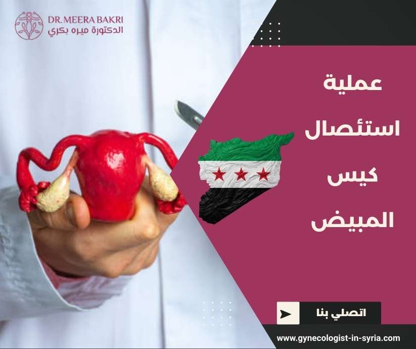 عملية استئصال كيس المبيض