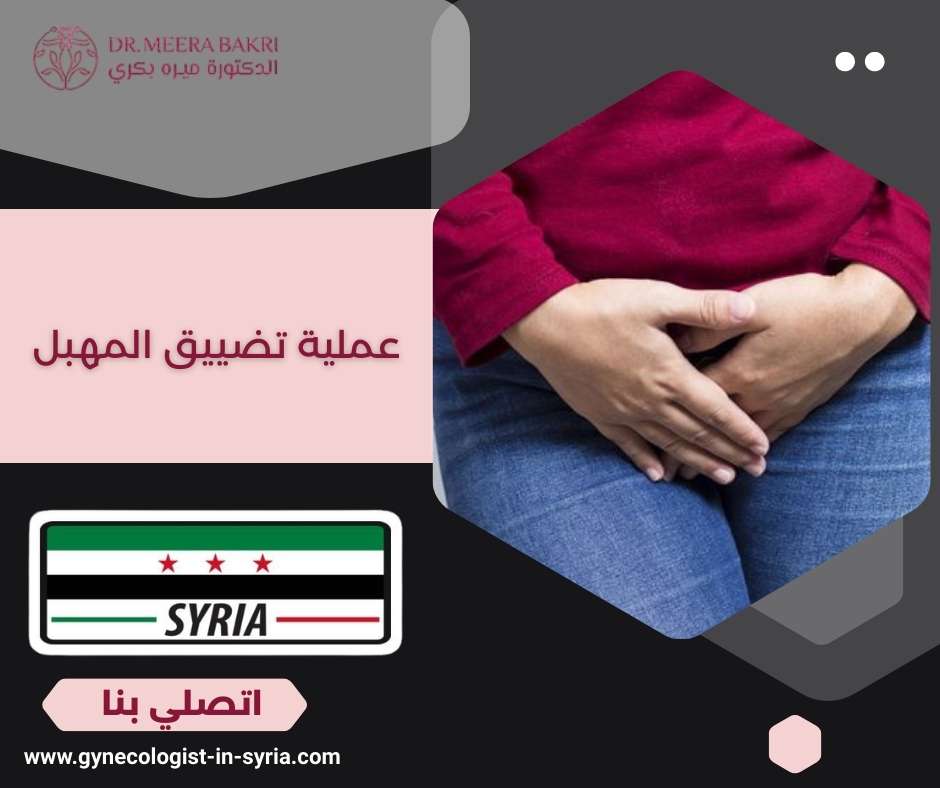 عملية تضييق المهبل