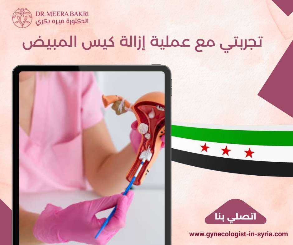 تجربتي مع عملية إزالة كيس المبيض