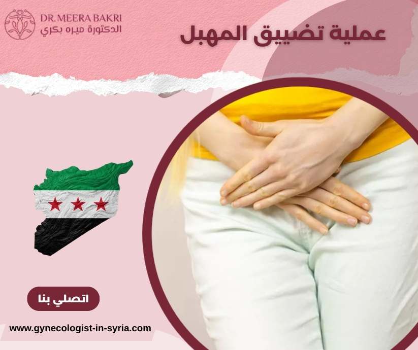 عملية تضييق المهبل