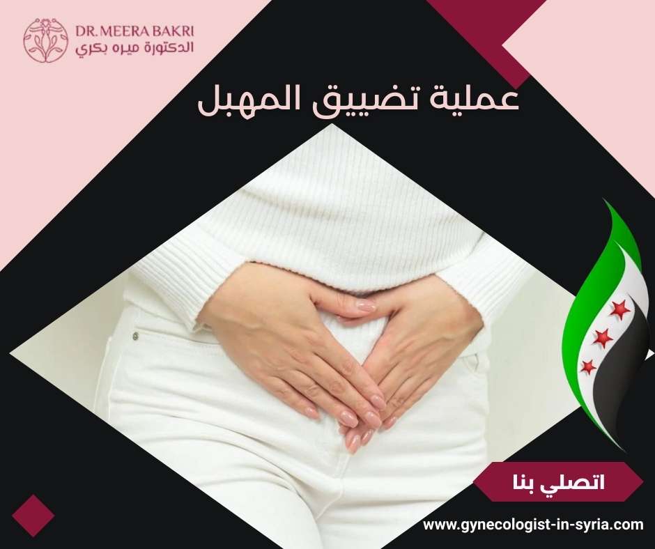 عملية تضييق المهبل