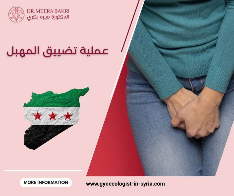 عملية تضييق المهبل