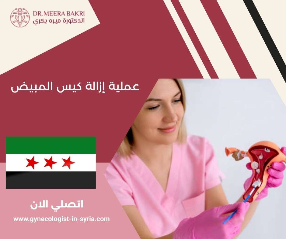 عملية إزالة كيس المبيض